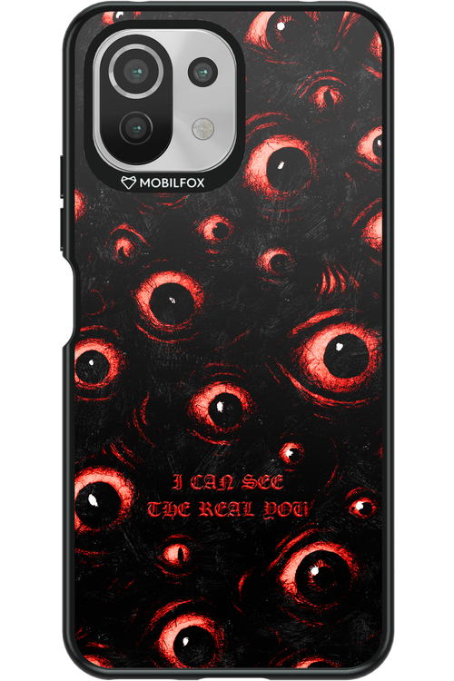 The Watchers - Xiaomi Mi 11 Lite (2021)