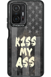 KISS II 2.0 - Xiaomi Mi 11T