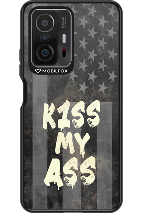 KISS II 2.0 - Xiaomi Mi 11T