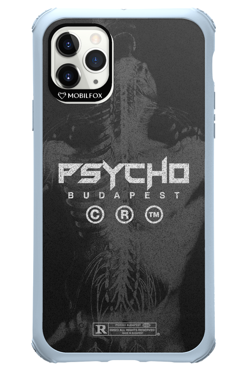 X-Ray - Apple iPhone 11 Pro Max
