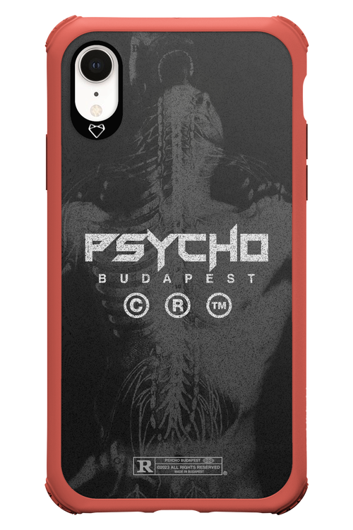 X-Ray - Apple iPhone XR
