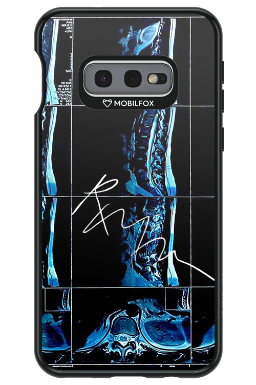 RMN Scolioza 2.0 - Samsung Galaxy S10e
