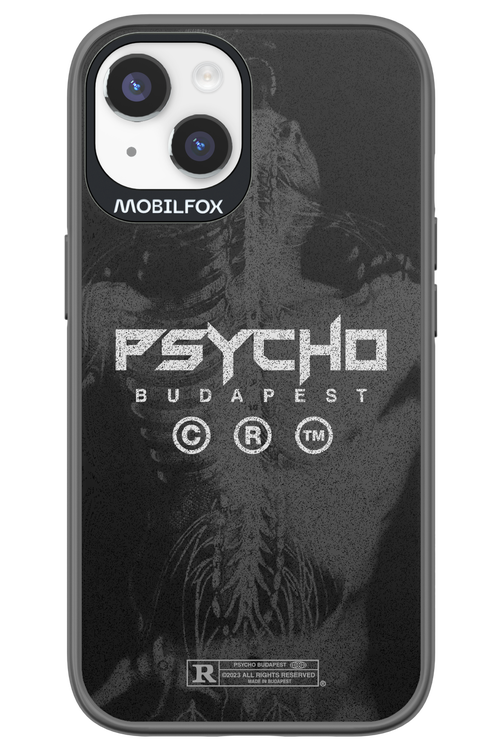 X-Ray - Apple iPhone 14