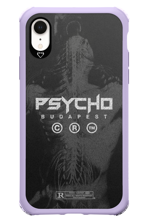 X-Ray - Apple iPhone XR