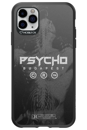 X-Ray - Apple iPhone 11 Pro Max
