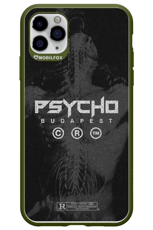 X-Ray - Apple iPhone 11 Pro Max