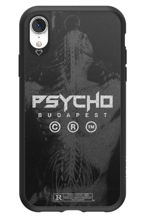 X-Ray - Apple iPhone XR