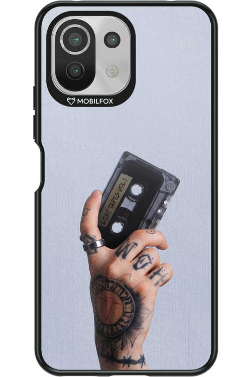 Bagabont 2.0 - Xiaomi Mi 11 Lite (2021)