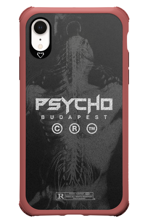 X-Ray - Apple iPhone XR