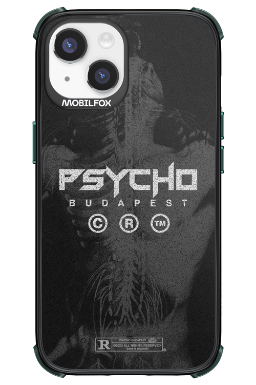 X-Ray - Apple iPhone 14