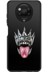 The Diamond King 2.0 - Xiaomi Poco X3 NFC