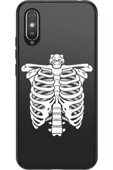 SKELETON - Xiaomi Redmi 9A