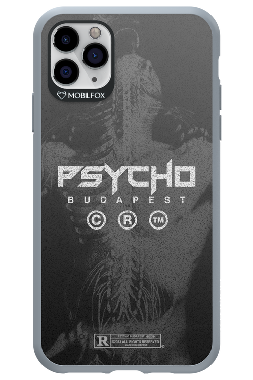 X-Ray - Apple iPhone 11 Pro Max