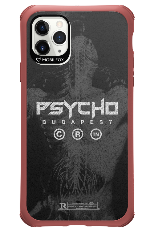 X-Ray - Apple iPhone 11 Pro Max