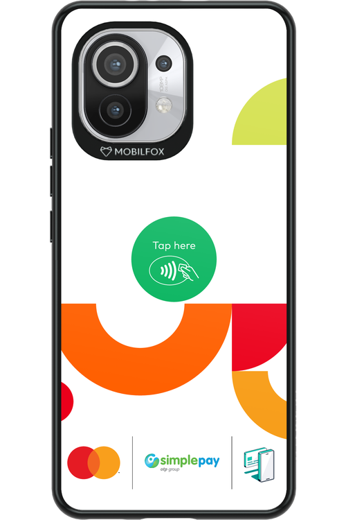 OTP EU Color 2.0 - Xiaomi Mi 11 5G