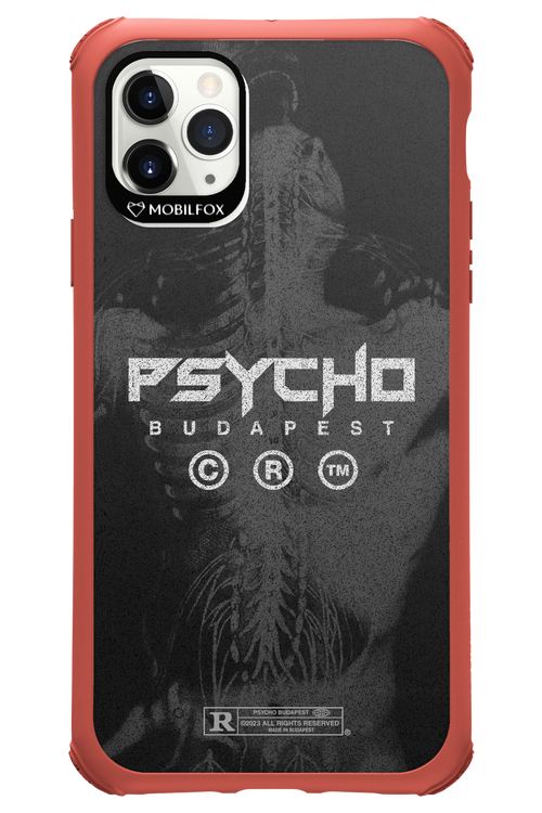 X-Ray - Apple iPhone 11 Pro Max
