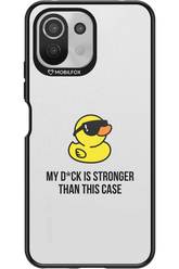 My D_ck (Transparent) 2.0 - Xiaomi Mi 11 Lite (2021)