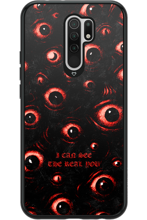 The Watchers - Xiaomi Redmi 9