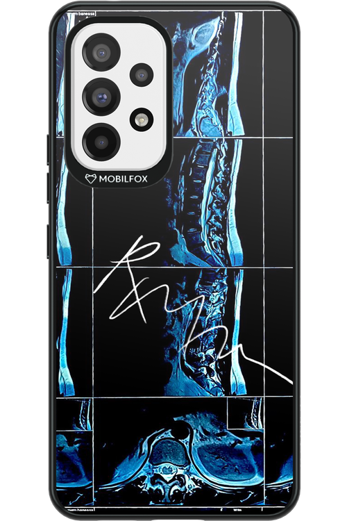 RMN Scolioza 2.0 - Samsung Galaxy A53