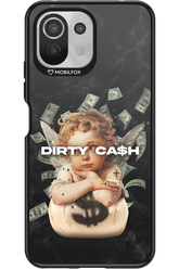 DirtyCash - Xiaomi Mi 11 Lite (2021)