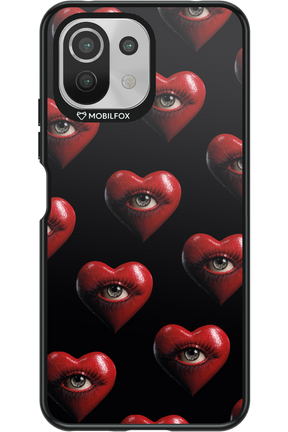 Heart Eyes - Xiaomi Mi 11 Lite (2021)