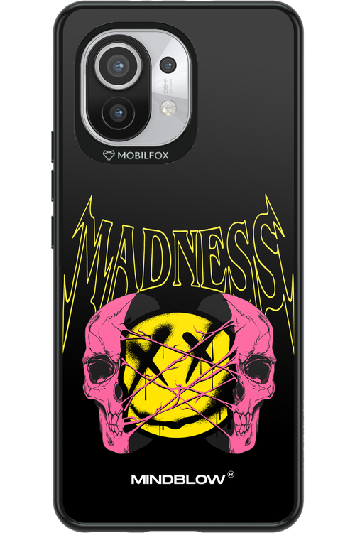 Madness Mindblow - Xiaomi Mi 11 5G