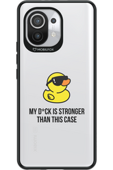 My D_ck (Transparent) 2.0 - Xiaomi Mi 11 5G