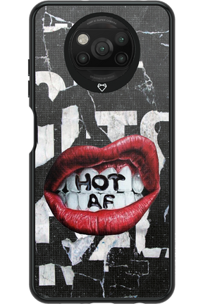 HOT AS F - Xiaomi Poco X3 NFC
