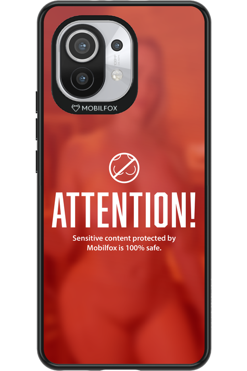 Attention 2.0 - Xiaomi Mi 11 5G